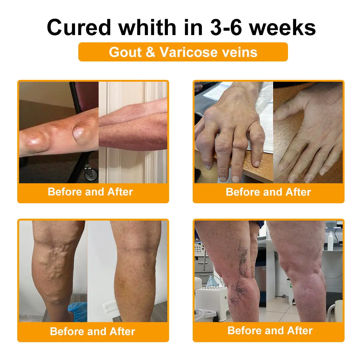 Botulinum Toxin & Bee Poison Pain-Relief Bone Healing Cream - Image 14