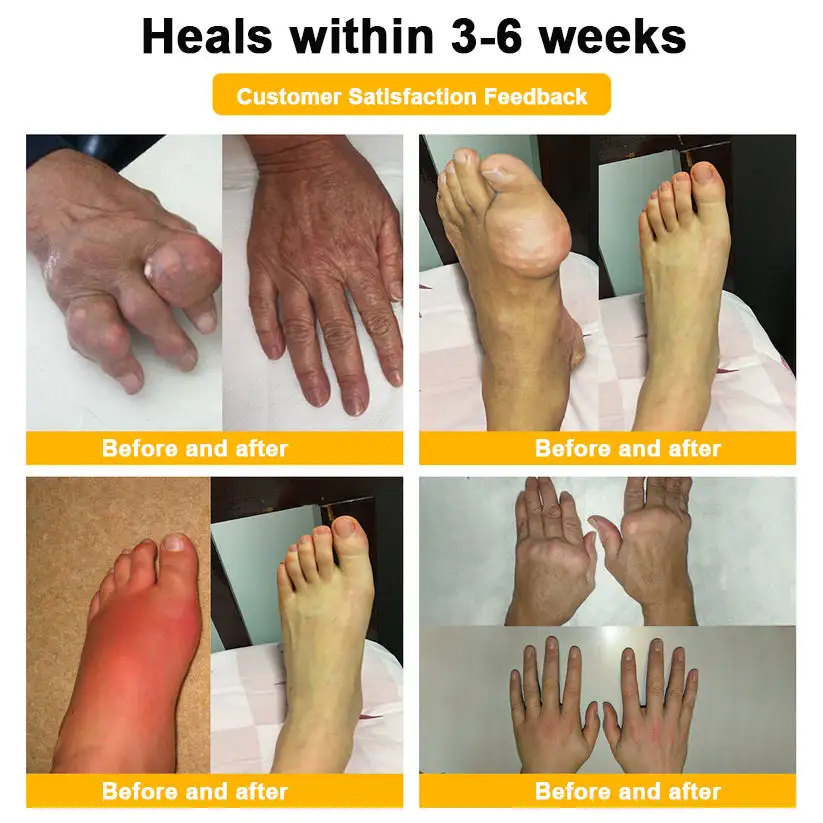 Botulinum Toxin & Bee Poison Pain-Relief Bone Healing Cream - Image 3