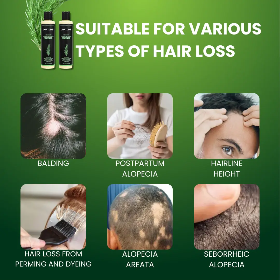 Rosemary Hydrolyzed Keratin Shampoo - Image 2