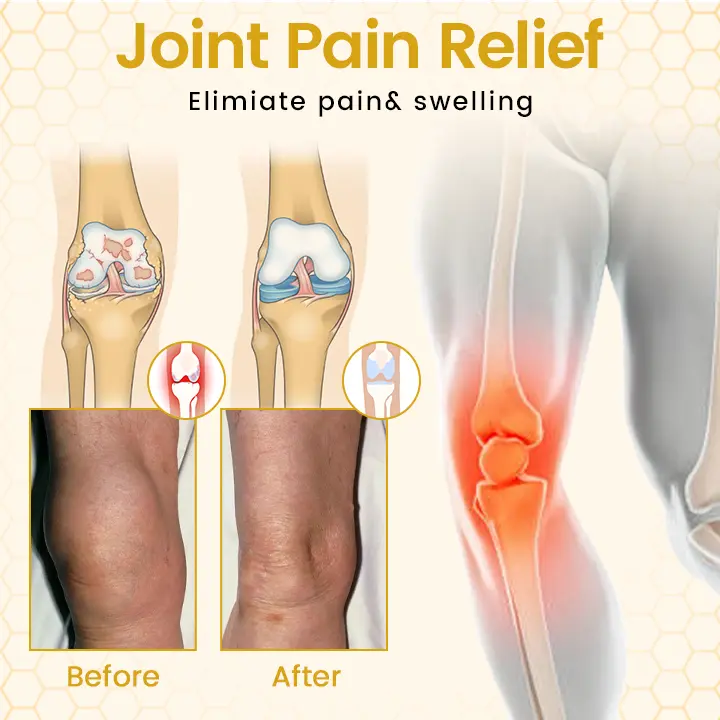 VenomFlex Bee Therapy Cream - Image 3