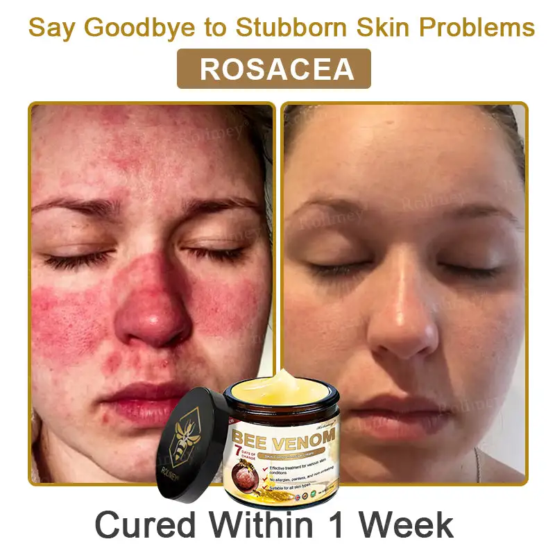 Bee Venom Skin Comprehensive Cream - Image 7
