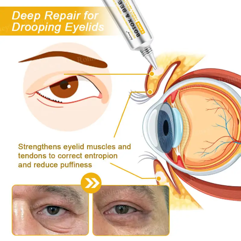Botox Bee Venom Wrinkle Removal Cream - Image 9