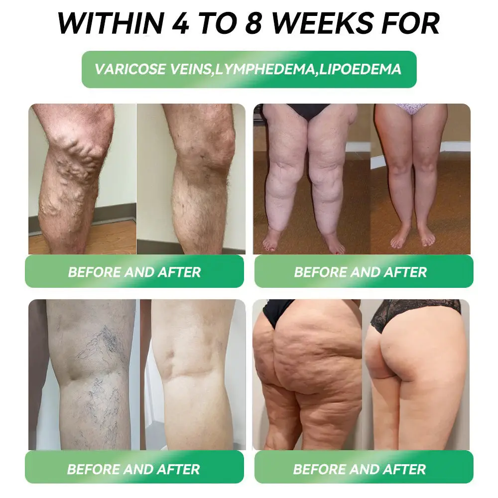 Telportide Oral Solution GIP Dual-Action Weight Loss Solution - Image 4