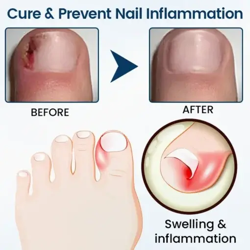 NailGuard Fungal Repair Herbal Spray - Image 5