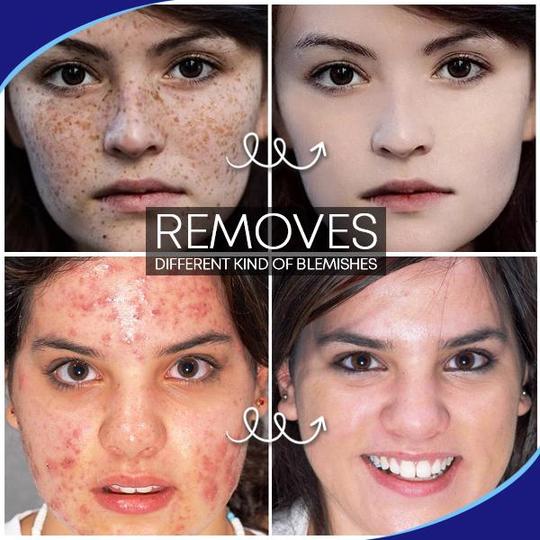 Pro.W Blemish Cream - Image 3