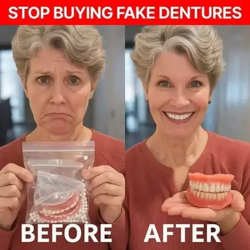 Custom-Fit Full Functional Dentures - Image 2