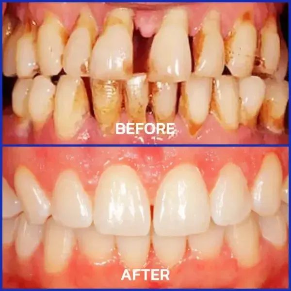 VioGloss Bee Venom Dental Therapy Oral Power - Image 10