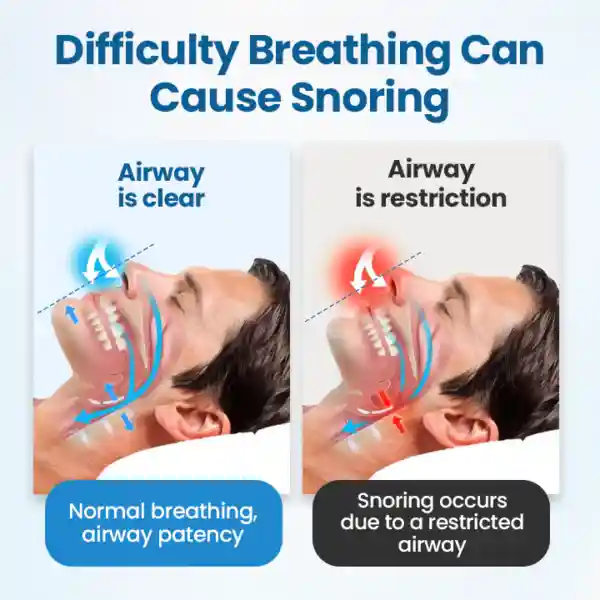 SnoreLess Nasal Breather
