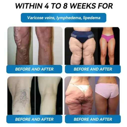 Super Concentrated Weight Loss Gum - Image 5