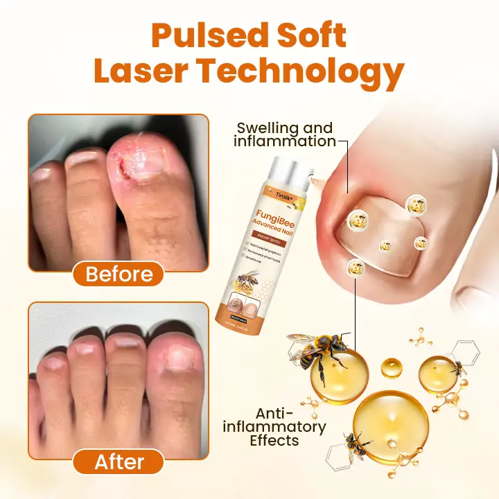 FungiBee Advanced Nail Repair Spray - Image 3