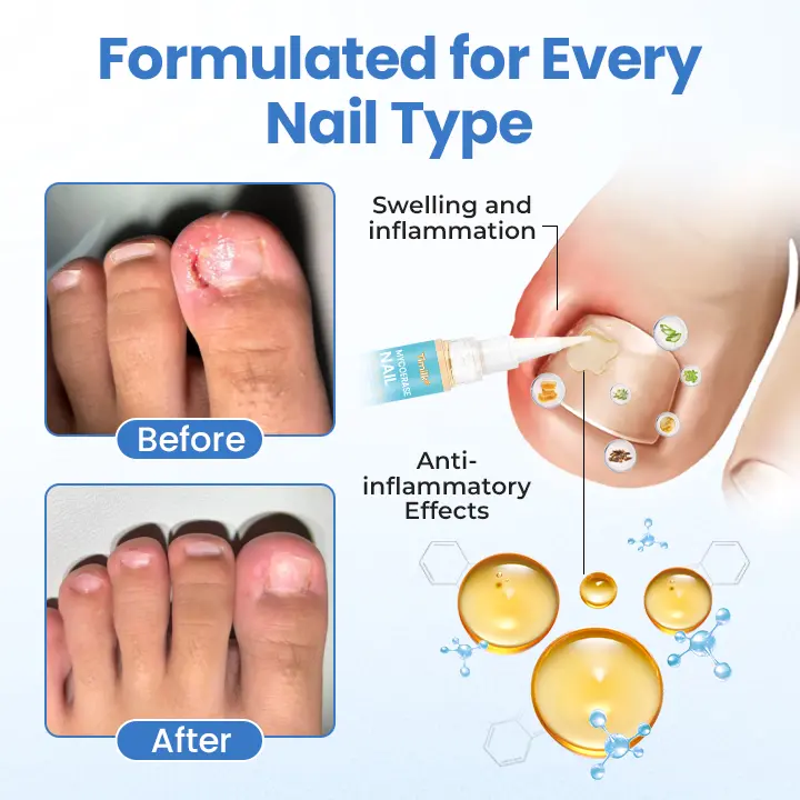MycoErase Nail Revive Pen - Image 10