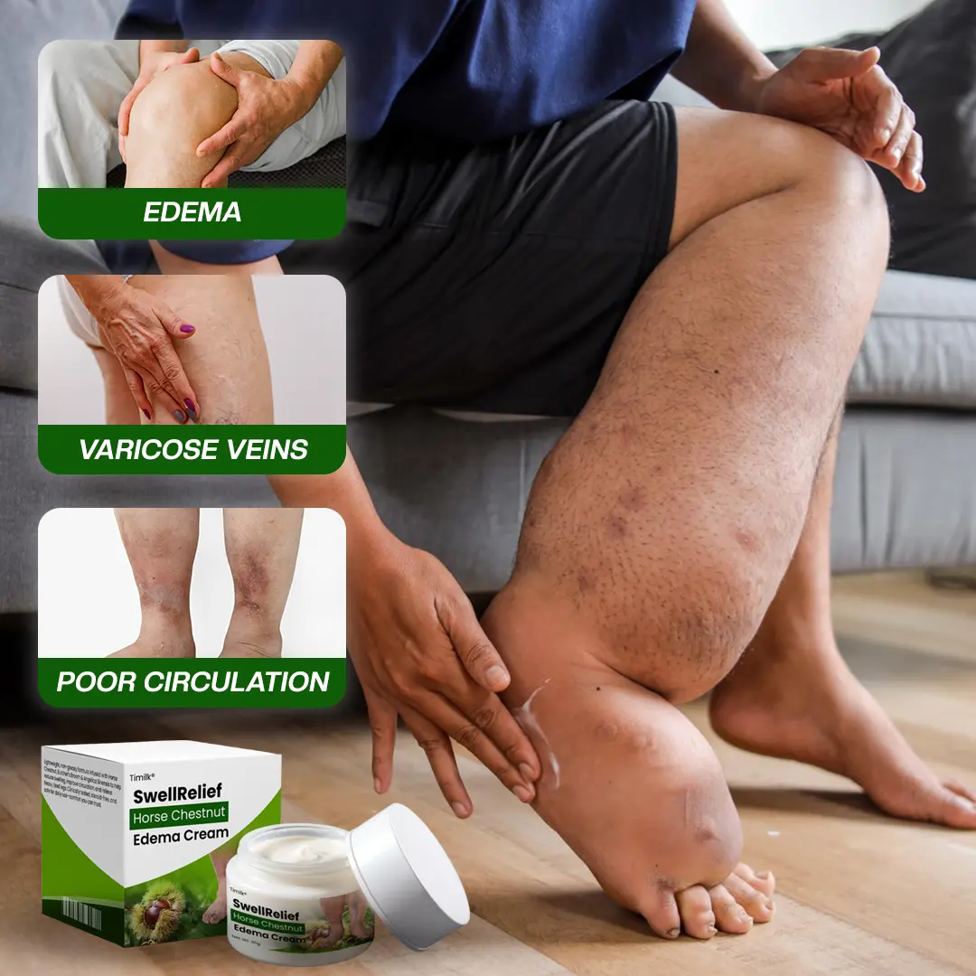 SwellRelief Horse Chestnut Edema Cream - Image 6