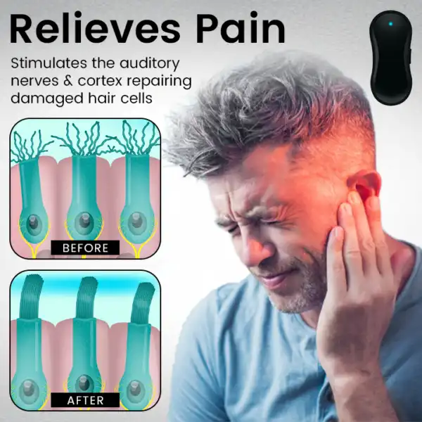 Tinnitus Relief Device Serenity