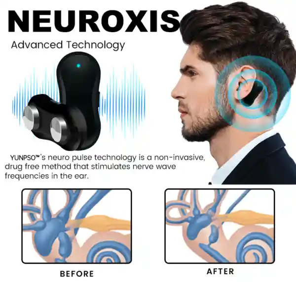 Tinnitus Relief Device Serenity
