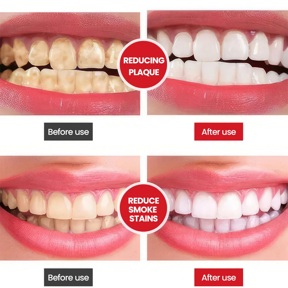 SP-6 Ultra+ Probiotic Whitening Toothpaste - Image 4