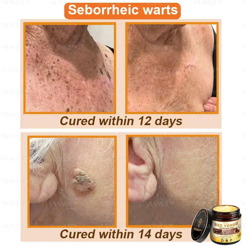 Bee Venom Skin Restoration Cream - Image 6