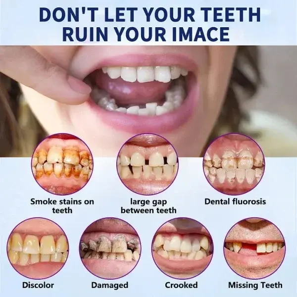 Advanced Customized Full Denture Set - Image 4