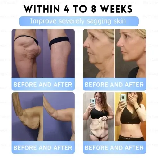 Slim & Firm đano đicroneedle đatch - Image 14