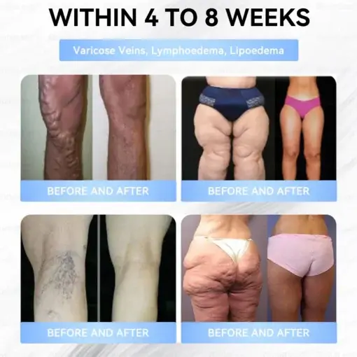 Slim & Firm đano đicroneedle đatch - Image 15