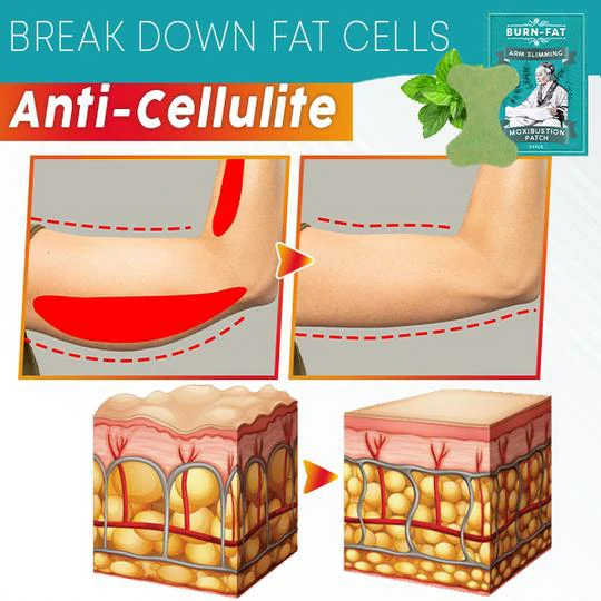 Burn-FAT Arm Slimming Moxibustion Patch (12PCS) - Image 6