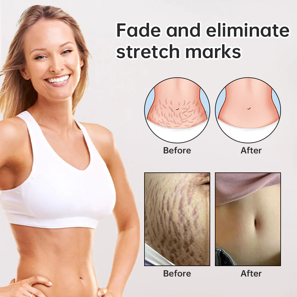 Natural Scar Removal Spray - Image 5
