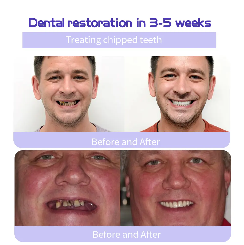 Winter Sale Teeth Restoration Mineral Powder - Image 6