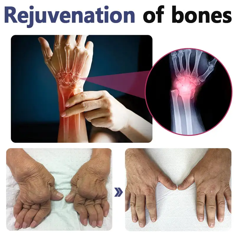 New Zealand Bee Venom Joint and Bone Therapy Advanced Cream - Image 6