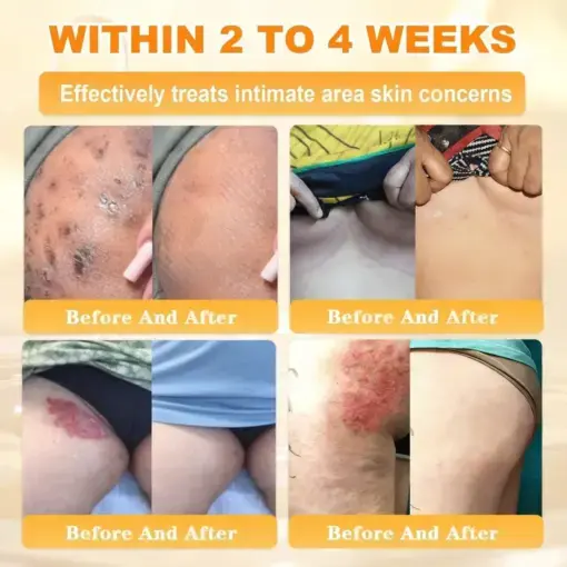 Bee Venom Skin Restoration Cream - Image 9
