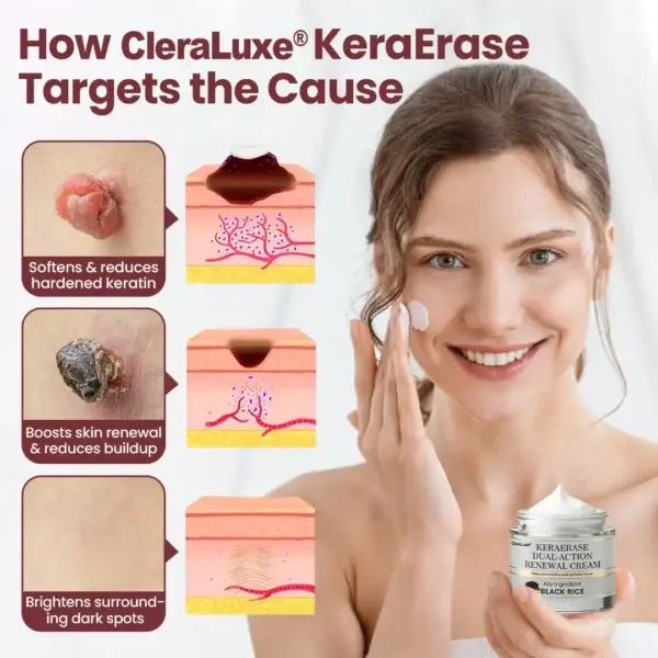 KeraErase Dual-Action Renewal Cream - Image 7