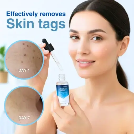 Advanced Skin Tag & Wart Removal Essence - Image 2