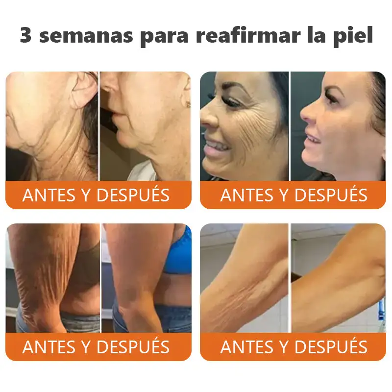 barra de esencia reafirmante con botox y veneno de abeja - Image 4