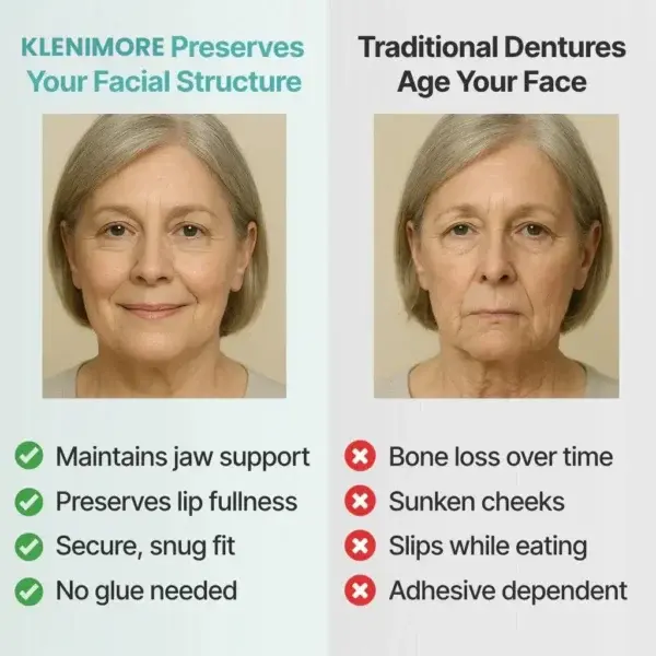 Custom-Fit Fully Functional Dentures - Image 13