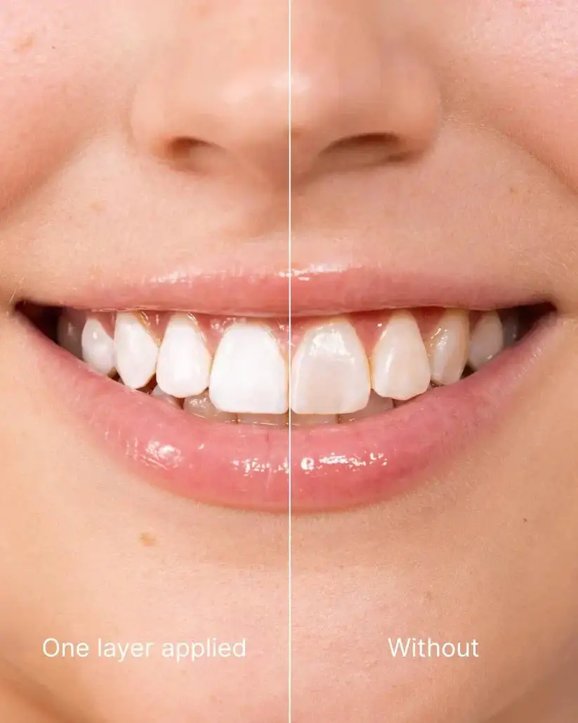 Tooth Polish - Instant Clean Smile - Image 6