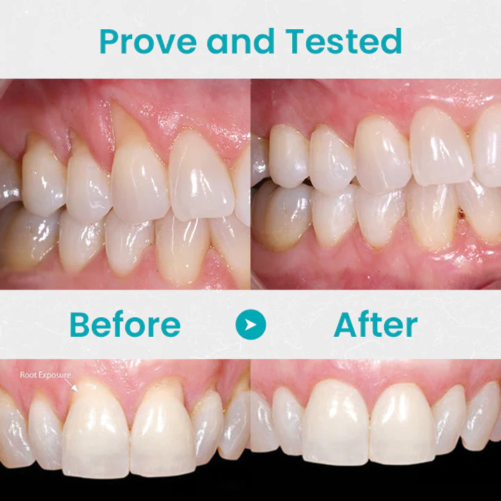 Gum Shield Therapy Gel - Image 7