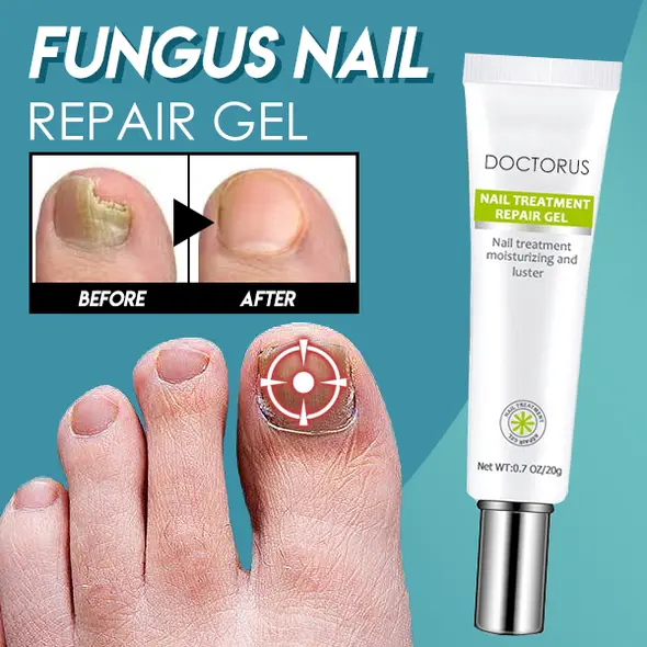 Fungus Nail Repair Gel