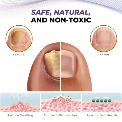 MycoOut Natural Nail Fungus Solution - Image 7