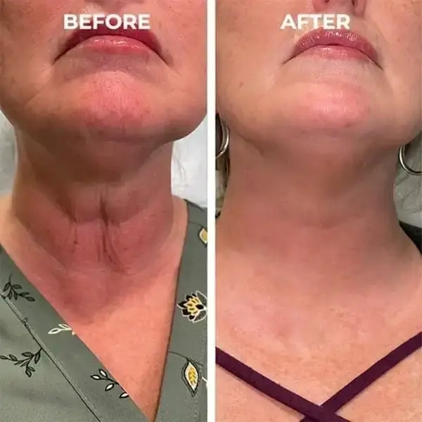 BotoxMAX Face Serum - Image 8