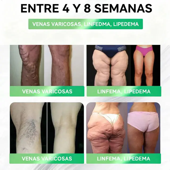 𝑺𝒐𝒍𝒖𝒄𝒊𝒐́𝒏 𝒐𝒓𝒂𝒍 8 𝒆𝒏 1 𝑭𝒊𝒕 & 𝑽𝒊𝒕𝒂𝒍 - Image 17