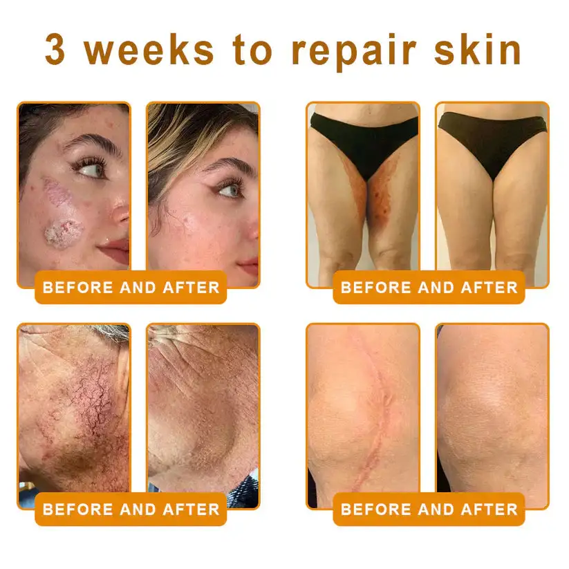 ๐๐๐ ๐๐๐ง๐จ๐ฆ ๐๐ฅ๐ฅ-๐ข๐ง-๐๐ง๐ ๐๐ซ๐๐๐ฆโAnti-Aging, Hydrating & Skin Repair - Image 4