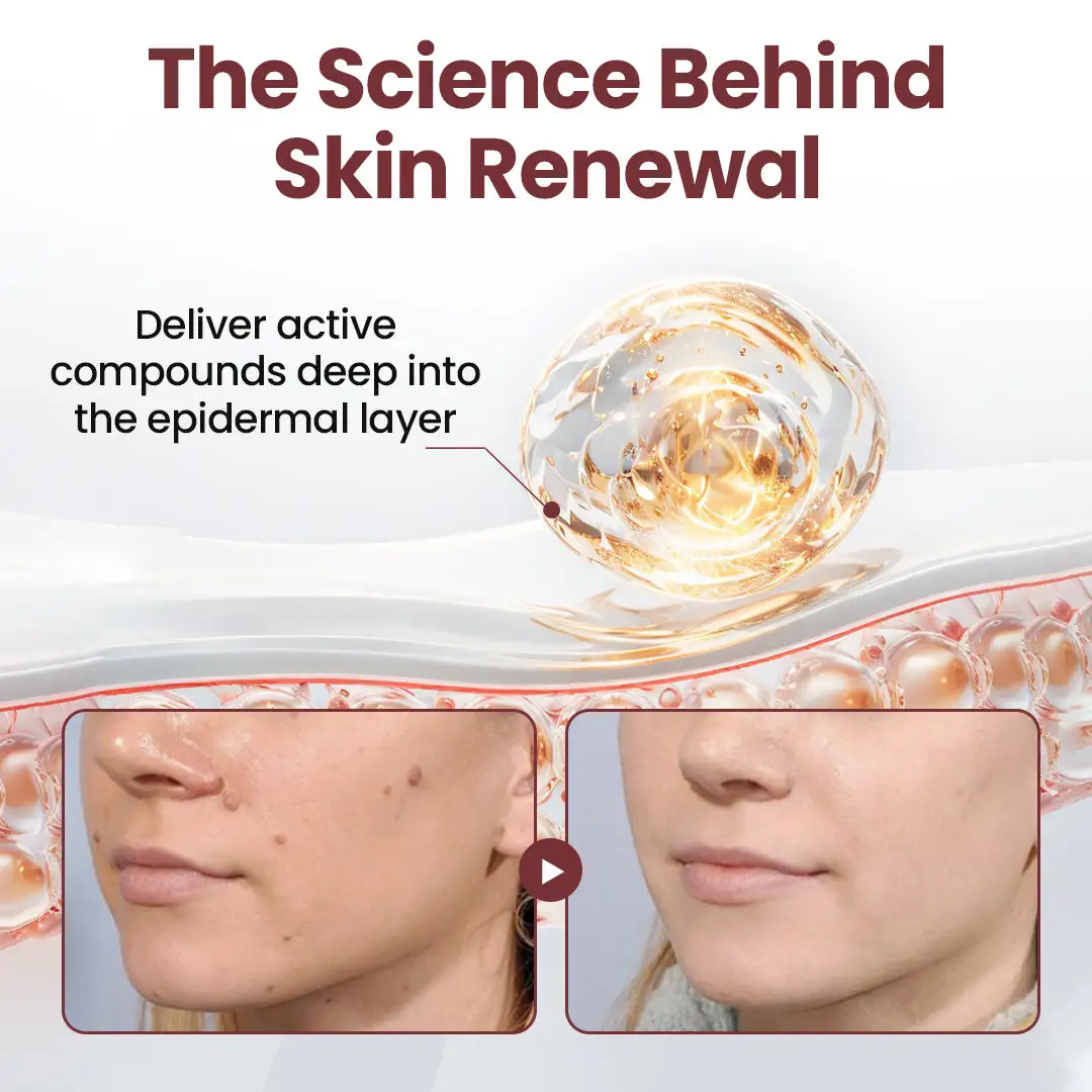 KeraErase Dual-Action Renewal Cream - Image 6