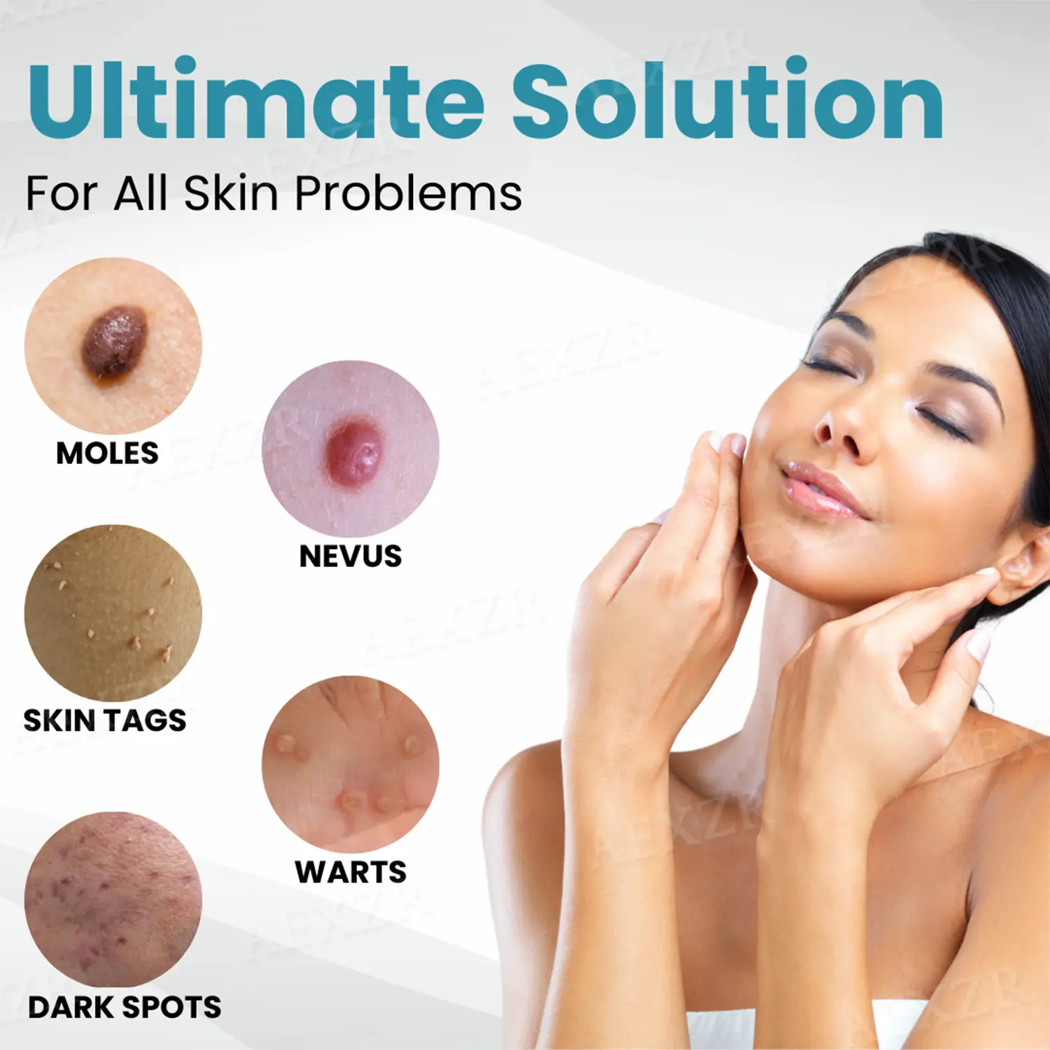 PRO Non-Invasive Mole and Wart Removal Laser Pen - Image 7