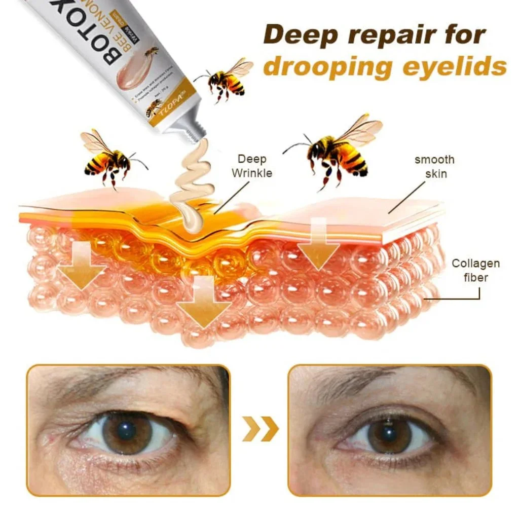 Botox Bee Venom Wrinkle Removal Cream - Image 4