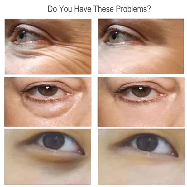 Caviar Eye Serum - Image 5