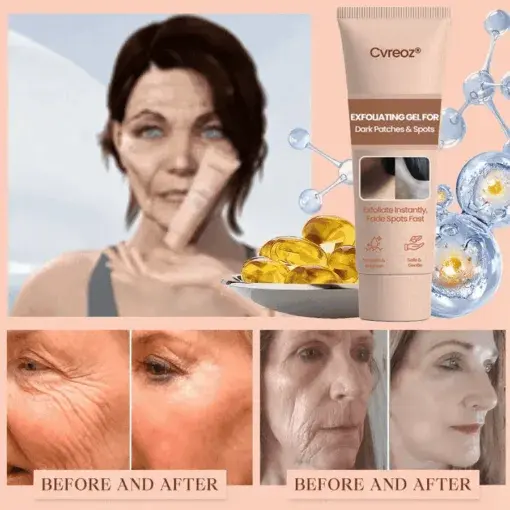 Purifying Exfoliating Gel - Image 11
