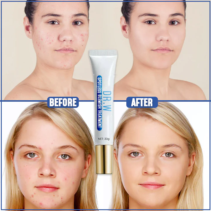 Dr. W Spotless Blemish Treatment - Image 3