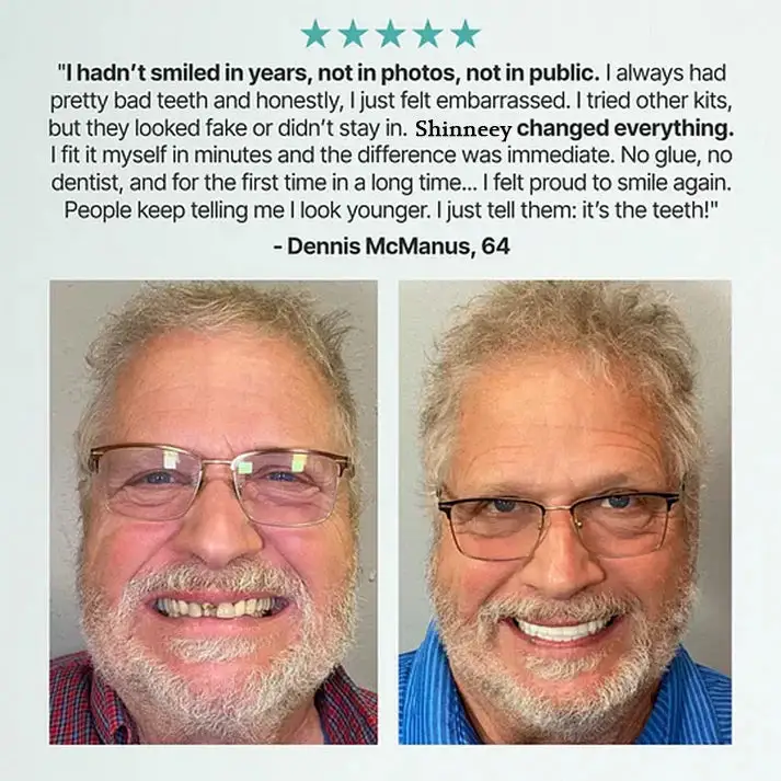 Custom-Fit Full Functional Dentures - Image 11