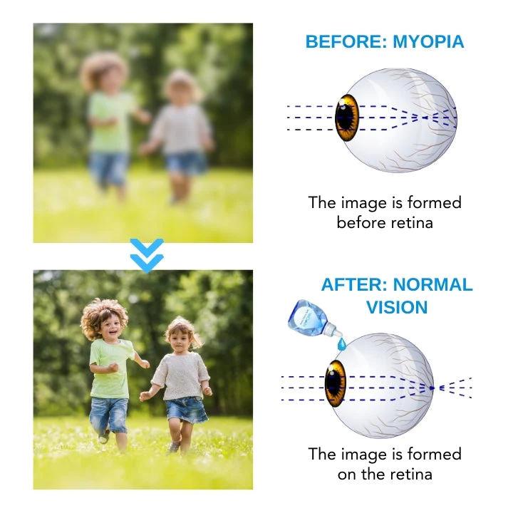 VisioClear Daily Liquid Lens - Image 4