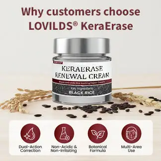 KeraErase Dual-Action Renewal Cream - Image 5