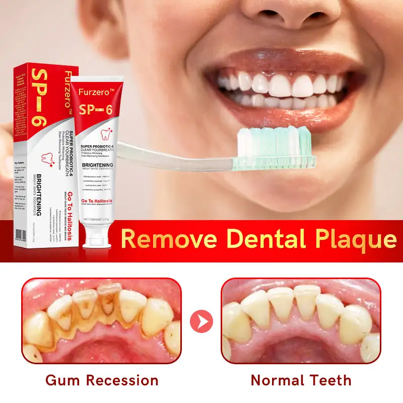 SP-6 Probiotic Ultra Whitening Toothpaste - Image 2