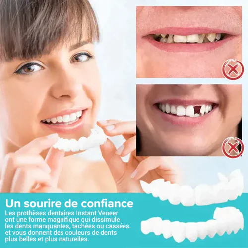 Prothèses ajustables à clipser - Image 5